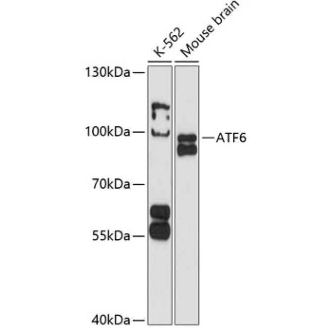 ATF6 Rabbit Polyclonal Antibody