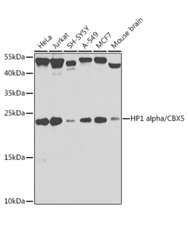 HP1 alpha/CBX5 Rabbit Polyclonal Antibody [KO Validated]
