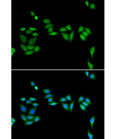 JADE1 Rabbit Polyclonal Antibody