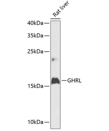 GHRL Rabbit Polyclonal Antibody