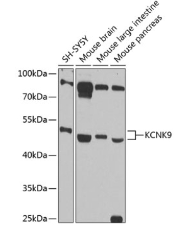 KCNK9 Rabbit Polyclonal Antibody