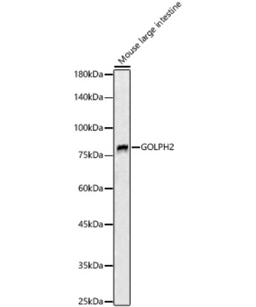 GOLPH2 Rabbit Polyclonal Antibody
