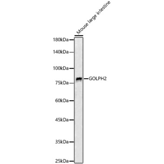 GOLPH2 Rabbit Polyclonal Antibody