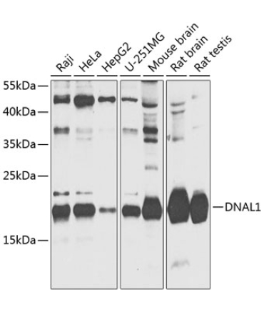 DNAL1 Rabbit Polyclonal Antibody