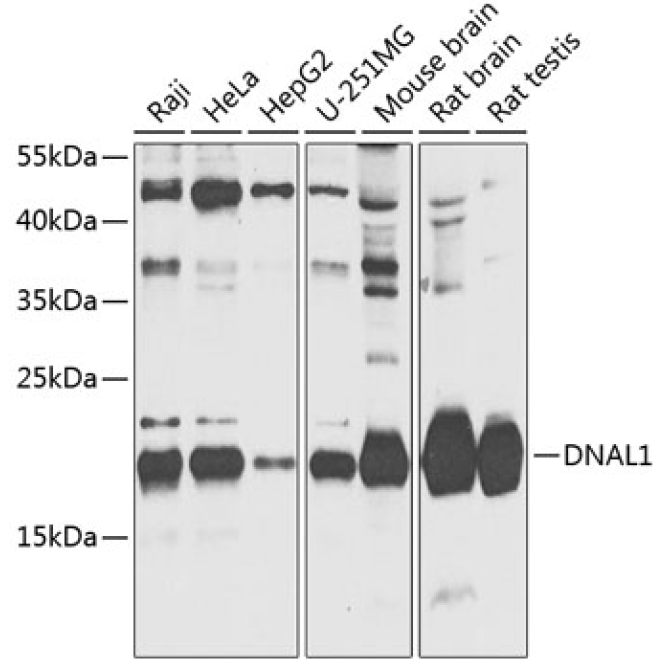 DNAL1 Rabbit Polyclonal Antibody