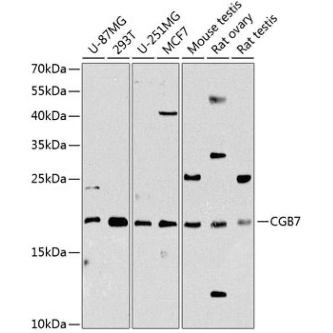 CGB7 Rabbit Polyclonal Antibody