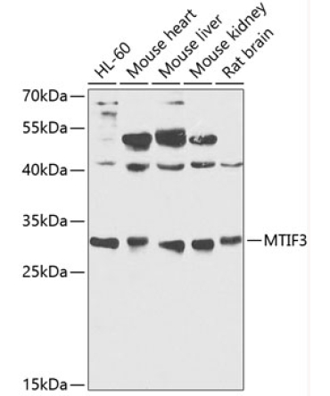 MTIF3 Rabbit Polyclonal Antibody