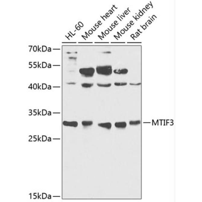 MTIF3 Rabbit Polyclonal Antibody