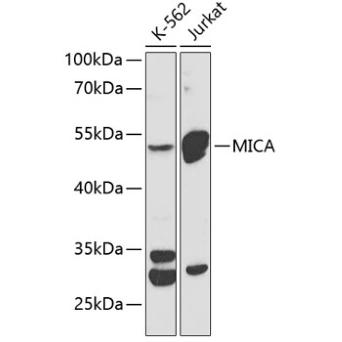 MICA Rabbit Polyclonal Antibody