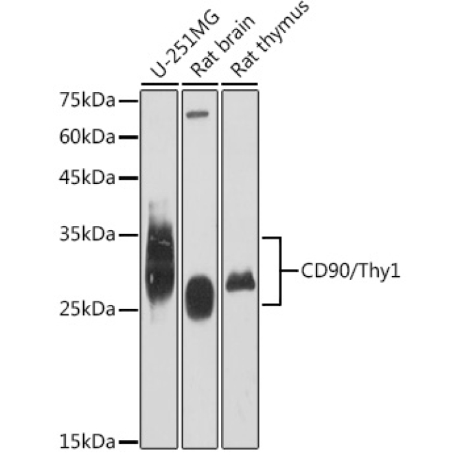 CD90/Thy1 Rabbit Monoclonal Antibody