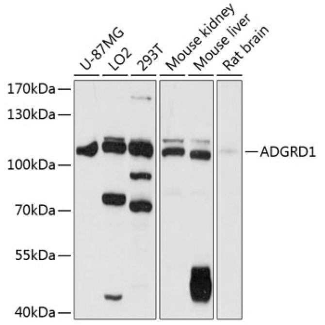 ADGRD1 Rabbit Polyclonal Antibody