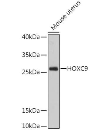 HOXC9 Rabbit Polyclonal Antibody
