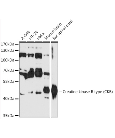 Creatine kinase B type (CKB) Rabbit Polyclonal Antibody