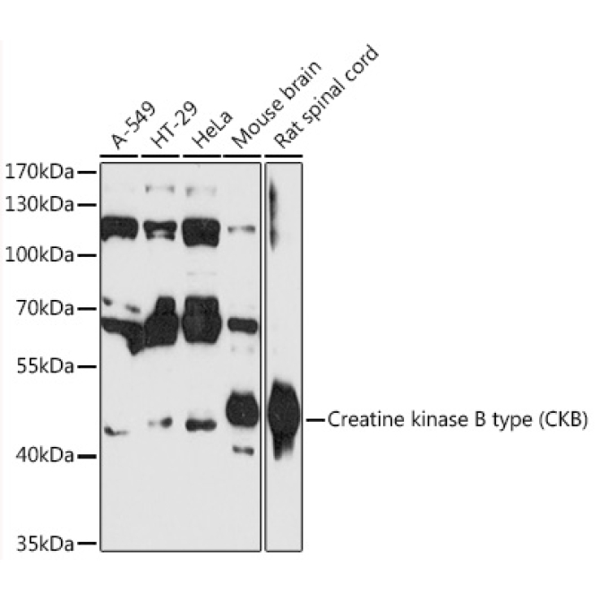 Creatine kinase B type (CKB) Rabbit Polyclonal Antibody