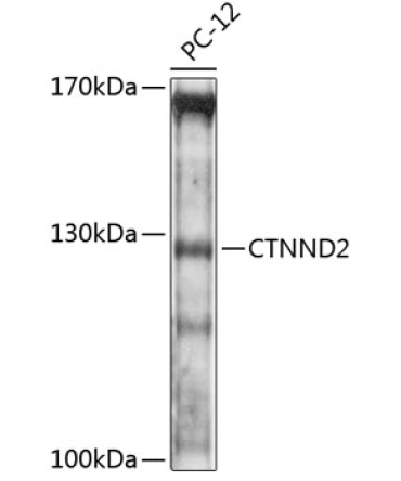 CTNND2 Rabbit Polyclonal Antibody