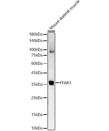 FFAR3 Rabbit Polyclonal Antibody