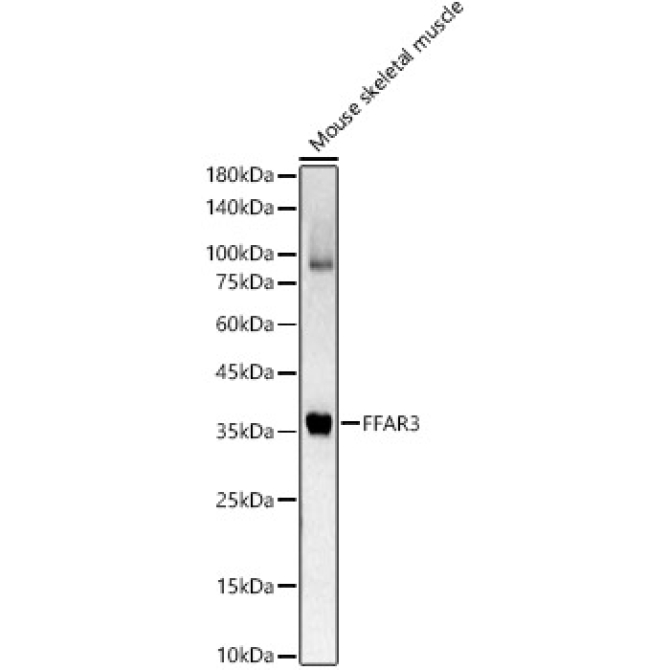 FFAR3 Rabbit Polyclonal Antibody
