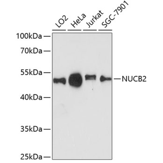 NUCB2 Rabbit Polyclonal Antibody