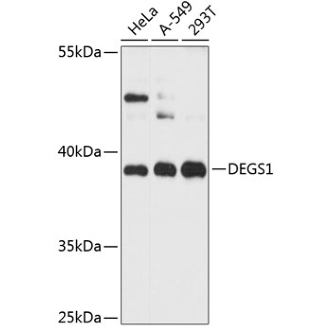 DEGS1 Rabbit Polyclonal Antibody