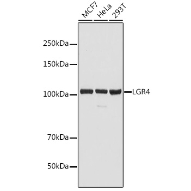 LGR4 Rabbit Polyclonal Antibody