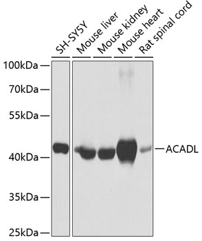 ACADL Rabbit Polyclonal Antibody