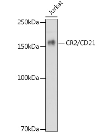 CR2/CD21 Rabbit Monoclonal Antibody