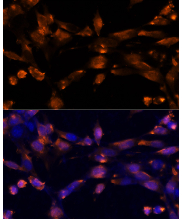 AREG Rabbit Polyclonal Antibody