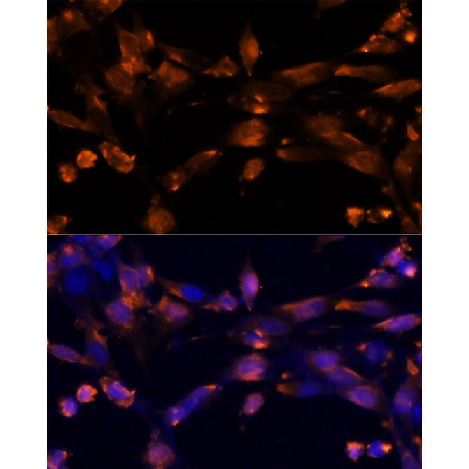 AREG Rabbit Polyclonal Antibody