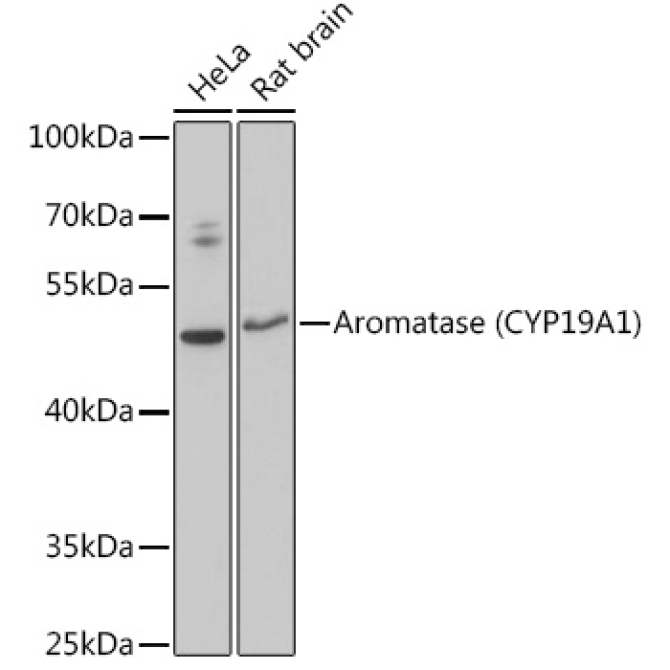 Aromatase (CYP19A1) Rabbit Polyclonal Antibody