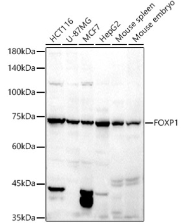 FOXP1 Rabbit Polyclonal Antibody