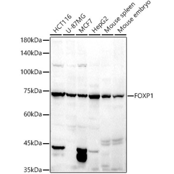 FOXP1 Rabbit Polyclonal Antibody