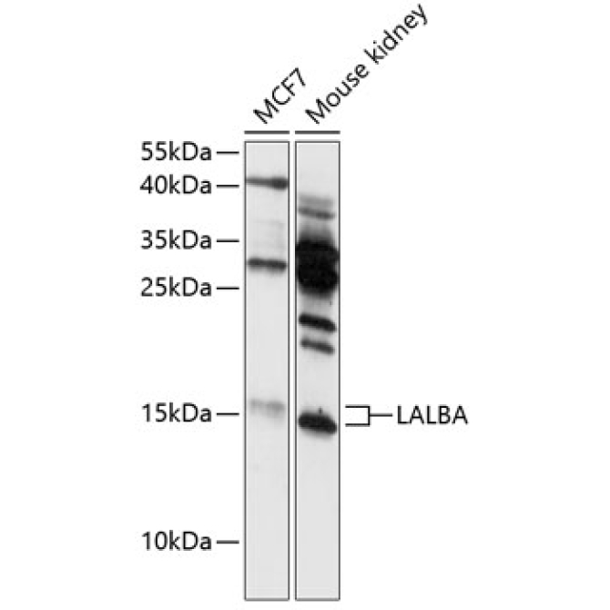 LALBA Rabbit Polyclonal Antibody