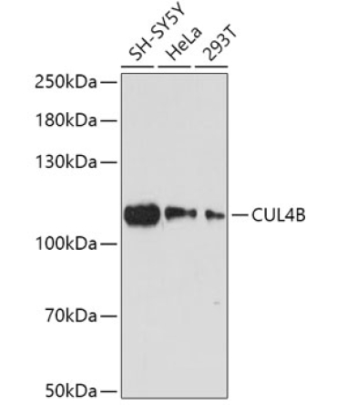 CUL4B Rabbit Polyclonal Antibody