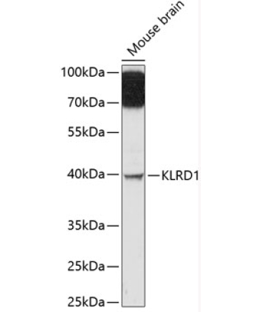 KLRD1 Rabbit Polyclonal Antibody