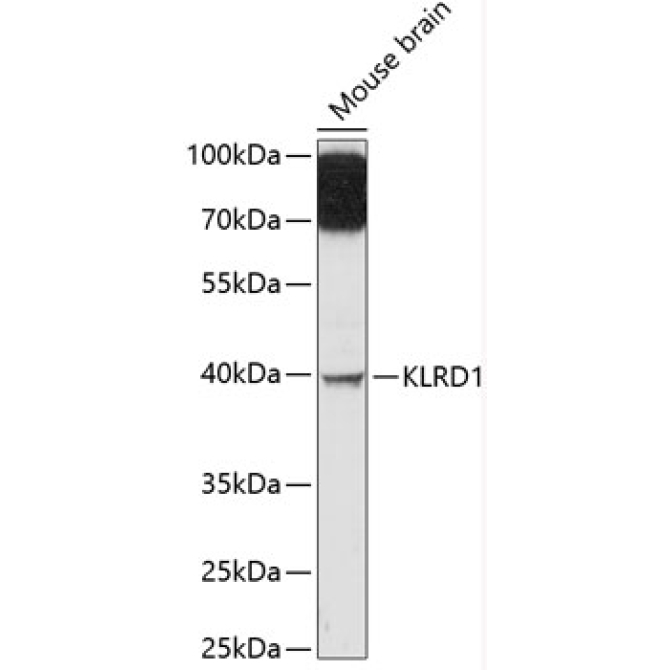 KLRD1 Rabbit Polyclonal Antibody