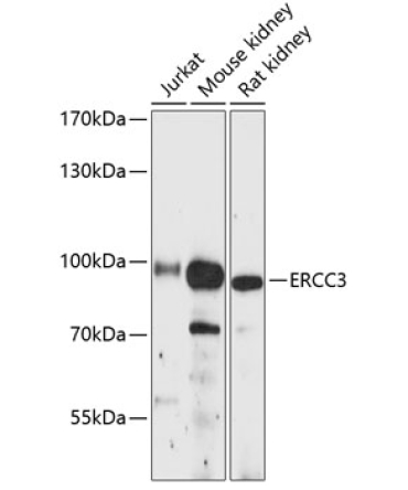 ERCC3 Rabbit Polyclonal Antibody