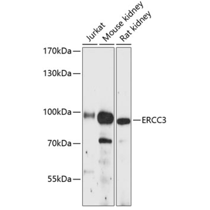 ERCC3 Rabbit Polyclonal Antibody