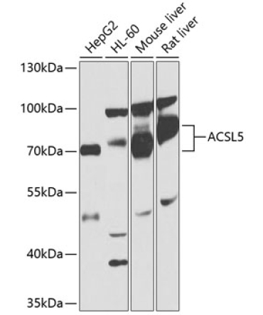 ACSL5 Rabbit Polyclonal Antibody
