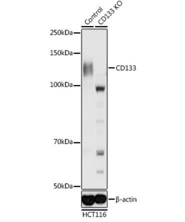 CD133 Rabbit Polyclonal Antibody [KO Validated]