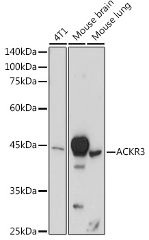 ACKR3 Rabbit Polyclonal Antibody