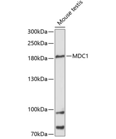 MDC1 Rabbit Polyclonal Antibody