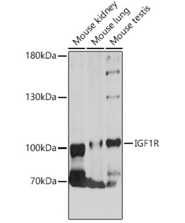 IGF1R Rabbit Polyclonal Antibody