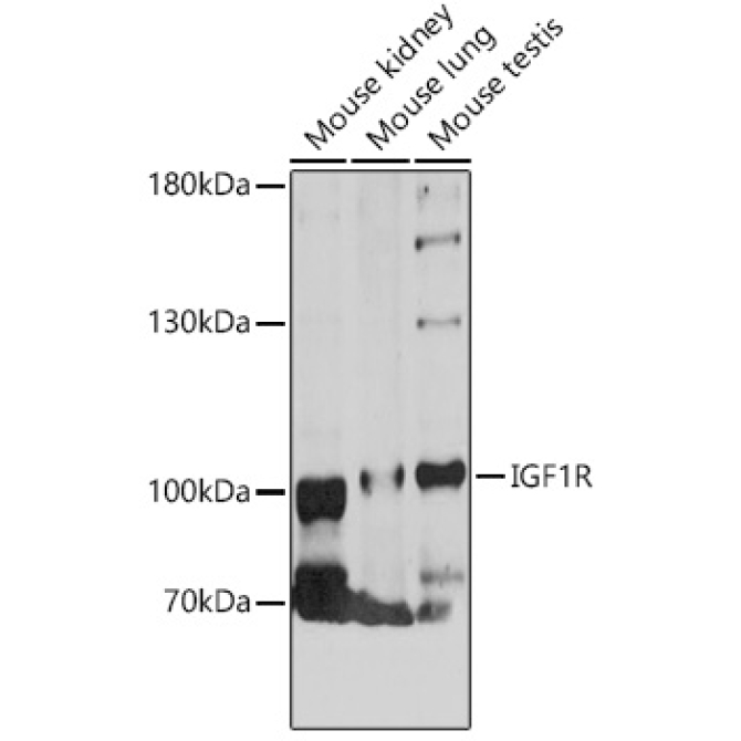 IGF1R Rabbit Polyclonal Antibody