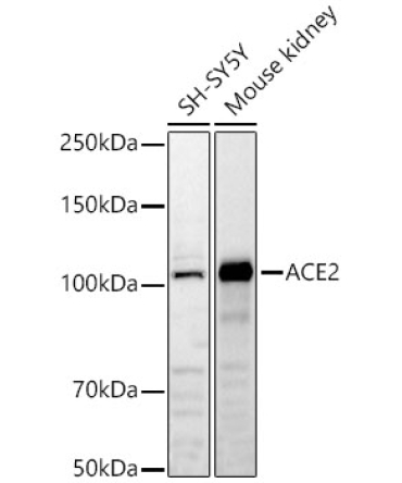 ACE2 Rabbit Polyclonal Antibody