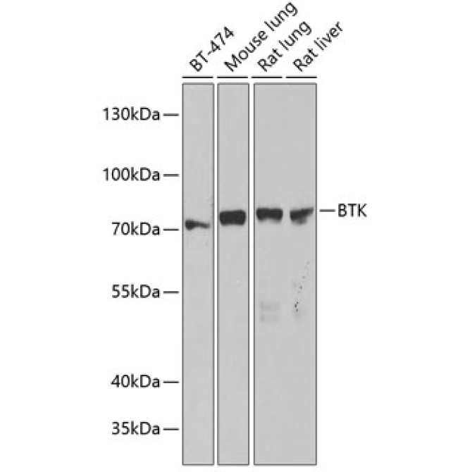 BTK Rabbit Polyclonal Antibody