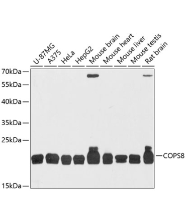 COPS8 Rabbit Polyclonal Antibody
