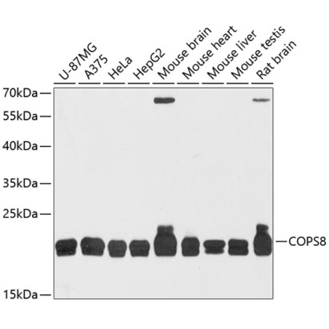 COPS8 Rabbit Polyclonal Antibody