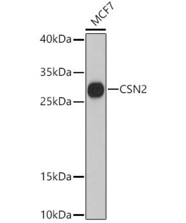 CSN2 Rabbit Polyclonal Antibody
