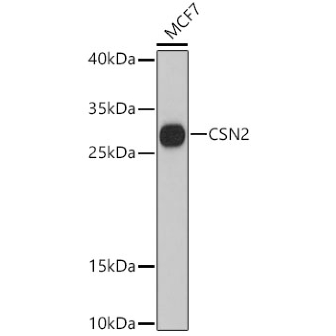 CSN2 Rabbit Polyclonal Antibody