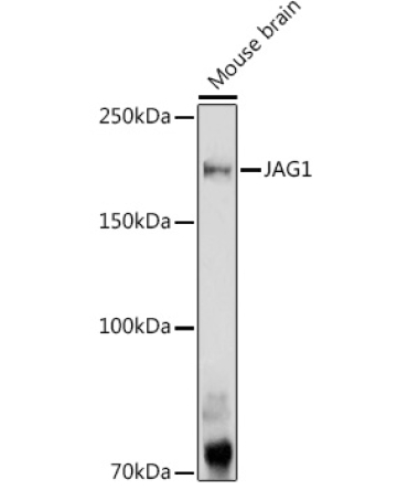 JAG1 Rabbit Polyclonal Antibody